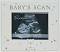   Widdop Bingham Baby Scan -   Bambino - 