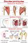 Shoulder Joint Injuries - 50 x 70 cm - ������