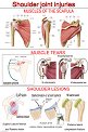 Shoulder Joint Injuries - 